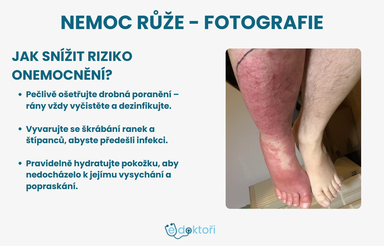 růže nemoc