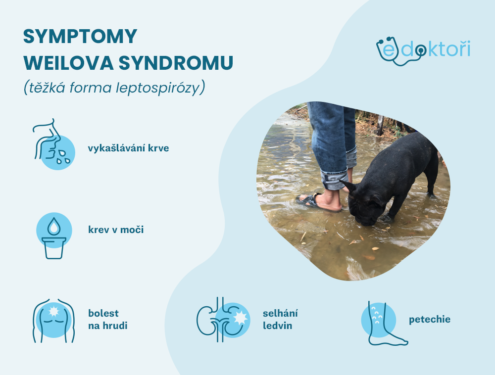 Autor: Redakce edoktori.cz příznaky Weilova syndromu