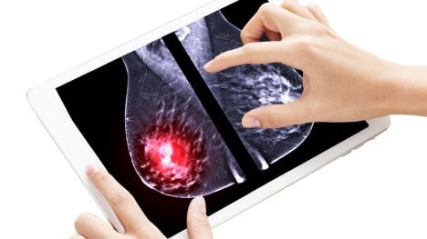 rentgenový snímek prsou