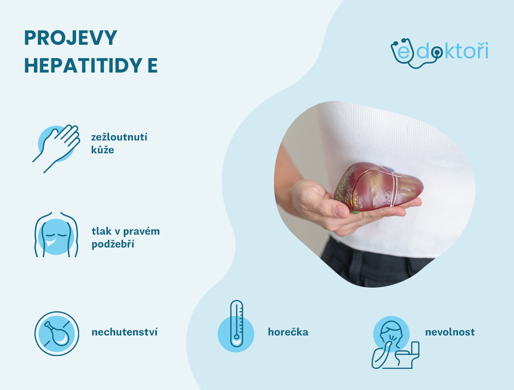 příznaky hepatitidy E