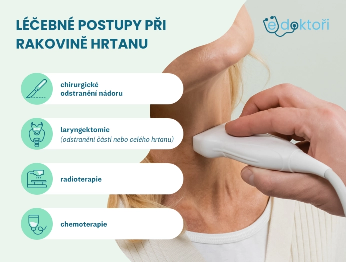 Léčba rakoviny hrtanu