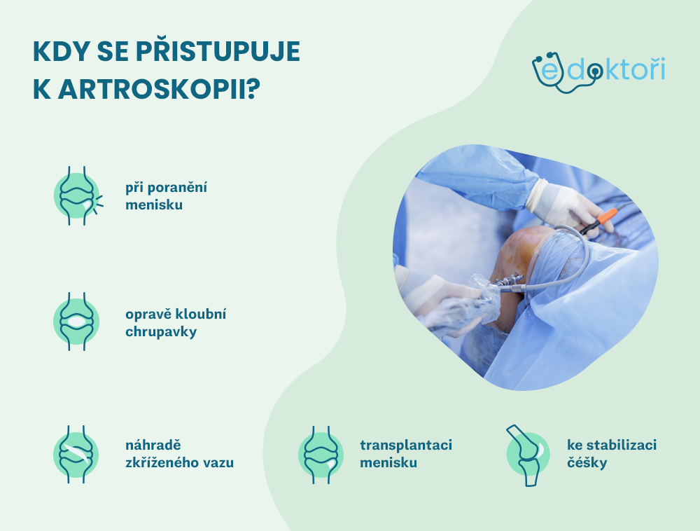 Autor: Redakce edoktori.cz Kdy se přistupuje k artroskopii?