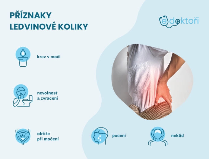 Ledvinová kolika příznaky