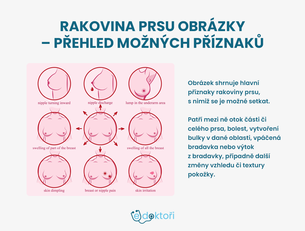 Autor: Redakce edoktori.cz rakovina prsu obrázky