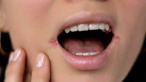 Popraskané koutky diskuze