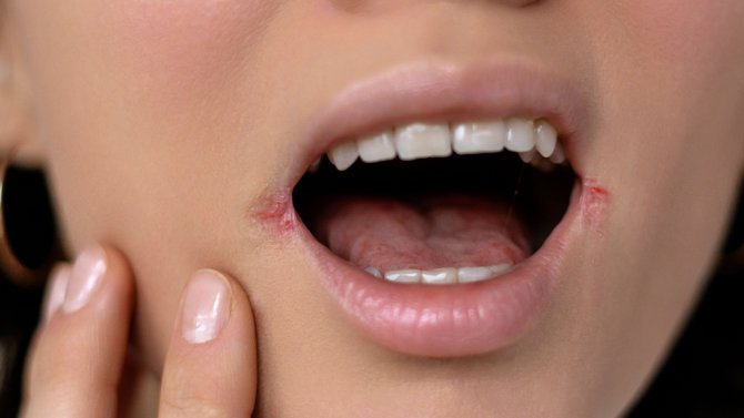 Popraskané koutky diskuze