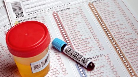 Vzorek moči a krve v nádobkách na lékařském formuláři