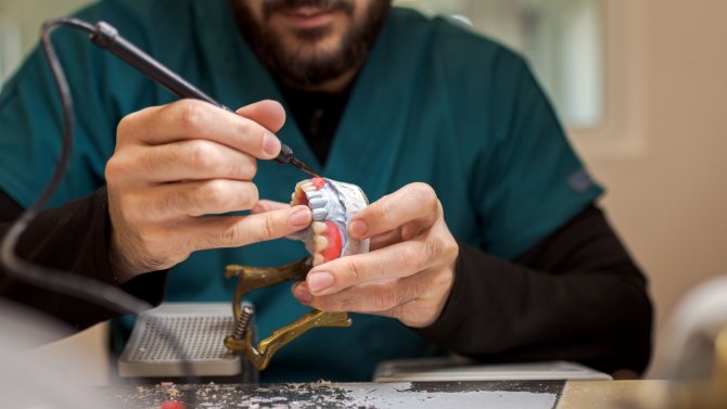 snímatelná zubní náhrada