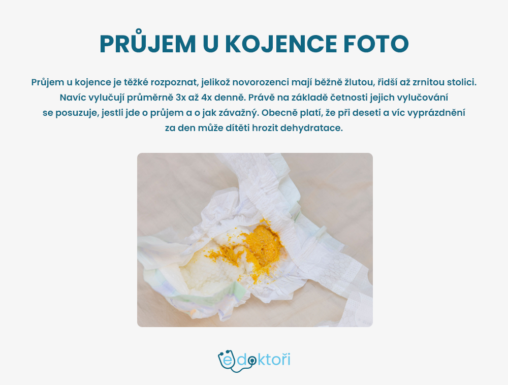 Autor: Redakce edoktori.cz průjem u kojence foto