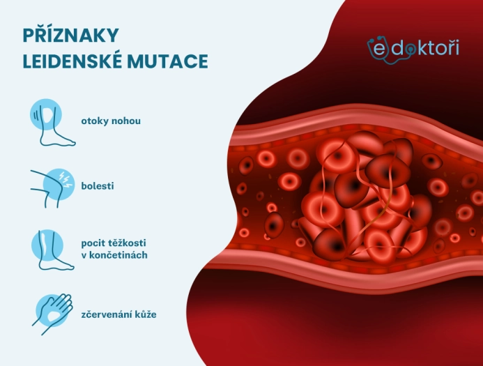 Jaké má Leidenská mutace příznaky?