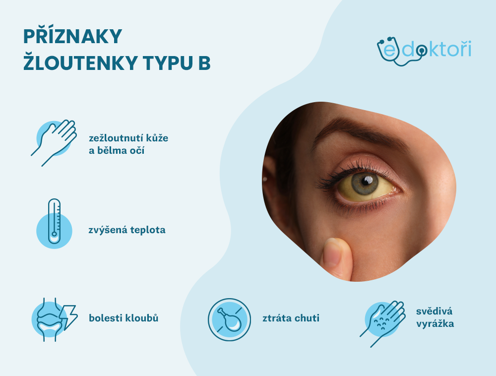 příznaky žloutenky typu B