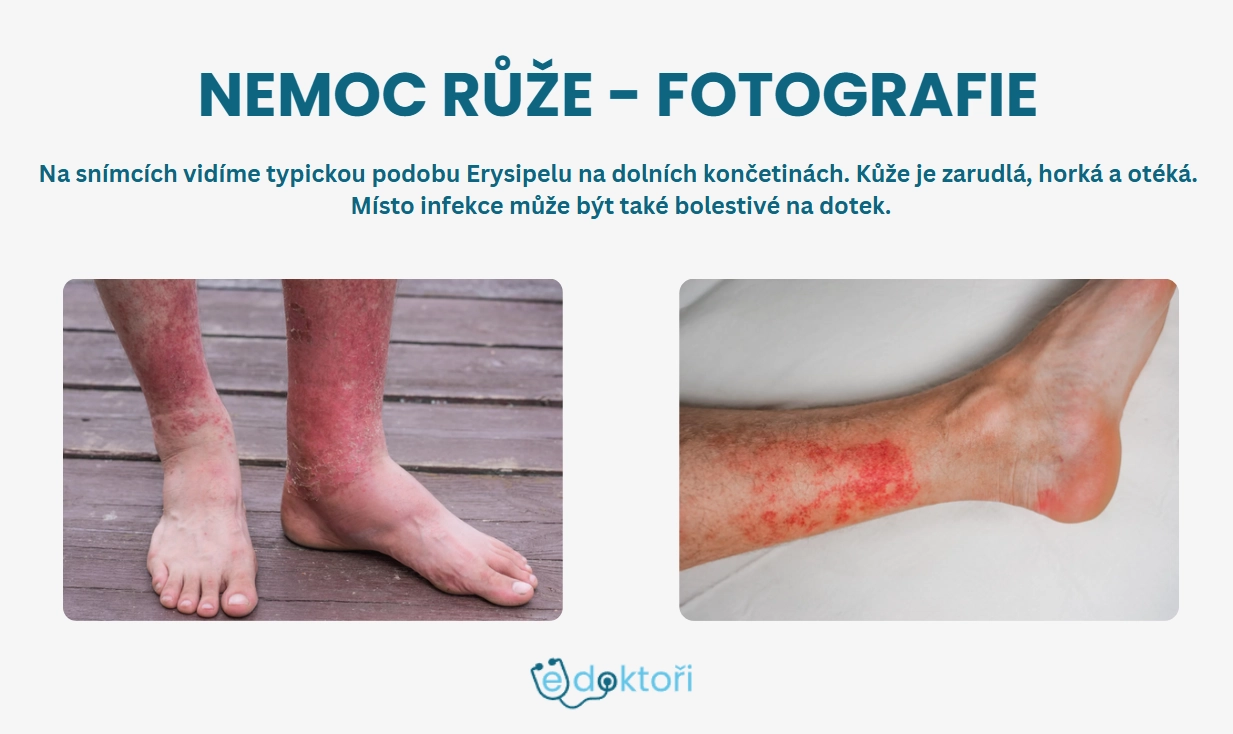 Nemoc růže obrázky