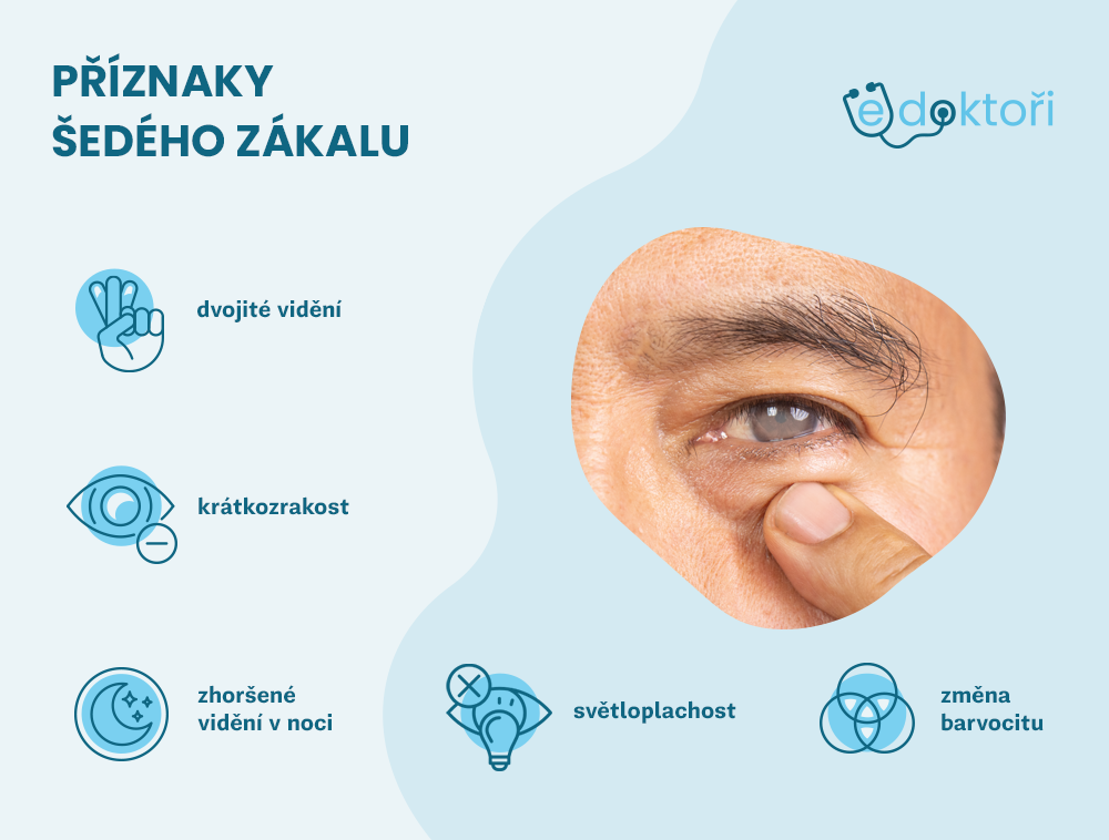 šedý zákal příznaky