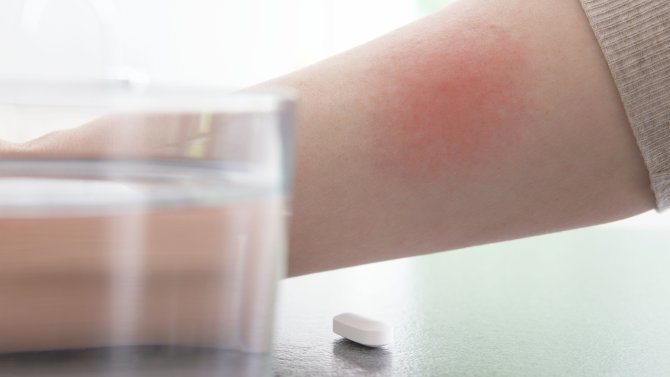 Borelióza a alkohol