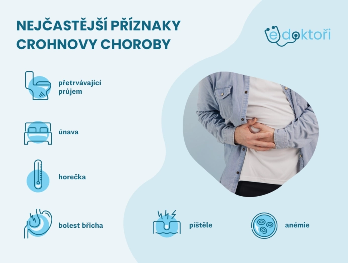 Příznaky Crohnovy choroby