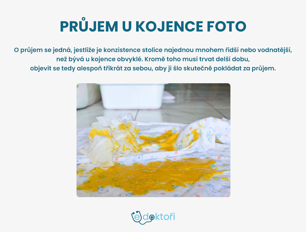 Autor: Redakce edoktori.cz průjem u kojence foto