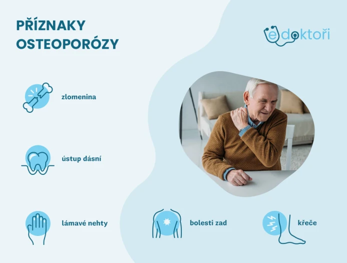 Příznaky osteoporózy