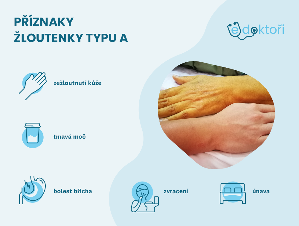 Příznaky žloutenky