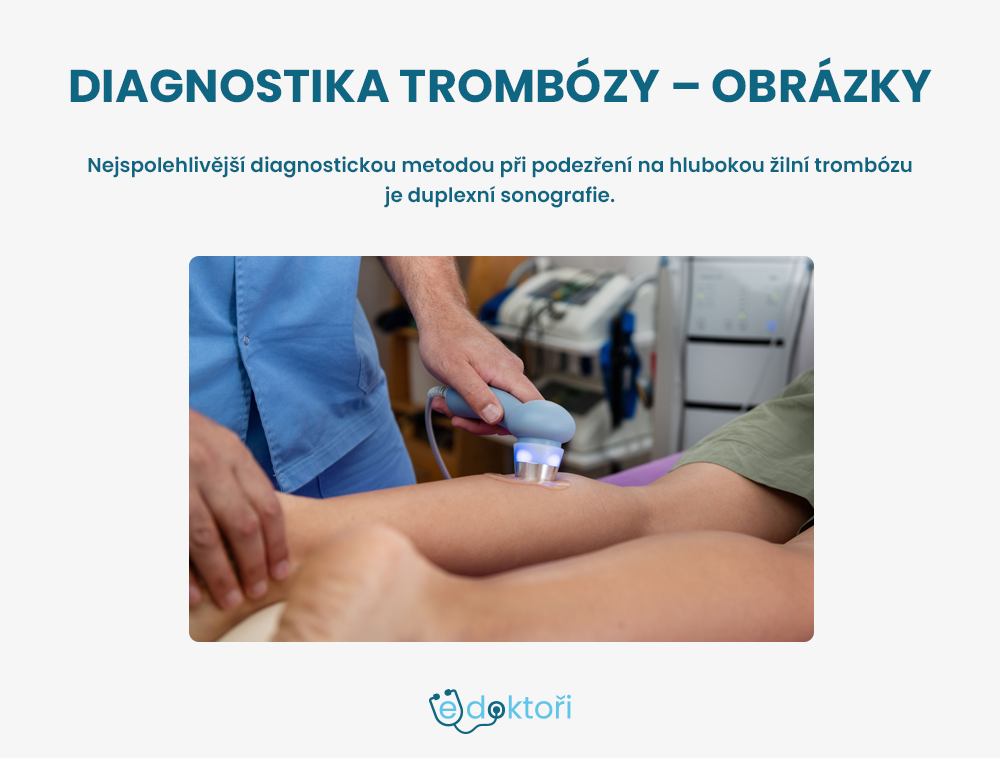 Diagnostika trombózy