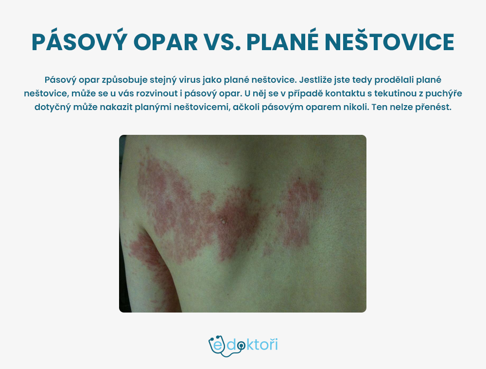 pásový opar fotografie