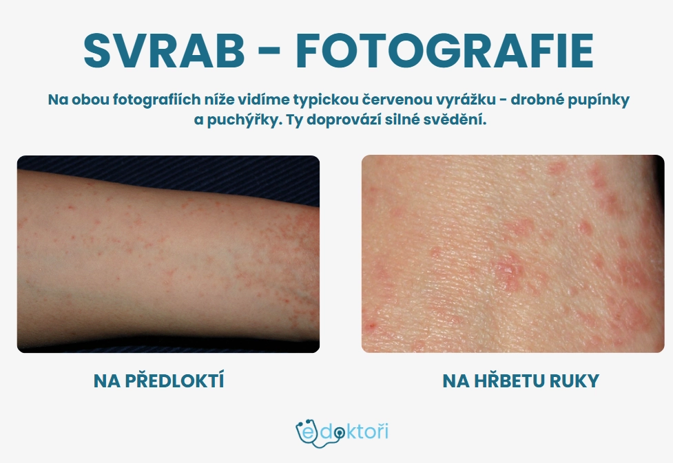 svrab fotografie