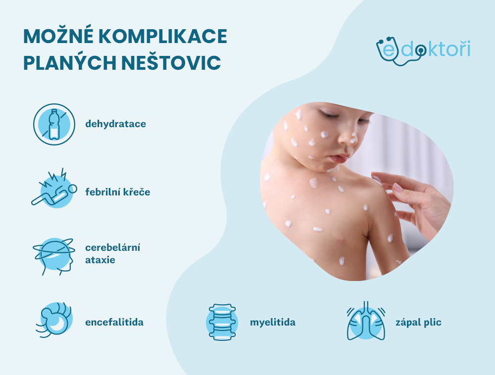 Plané neštovice komplikace
