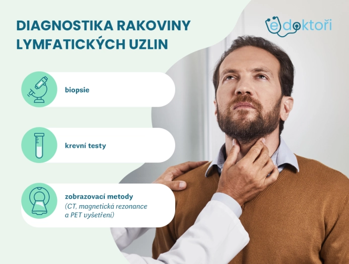 Jak se rakovina lymfatických uzlin diagnostikuje?