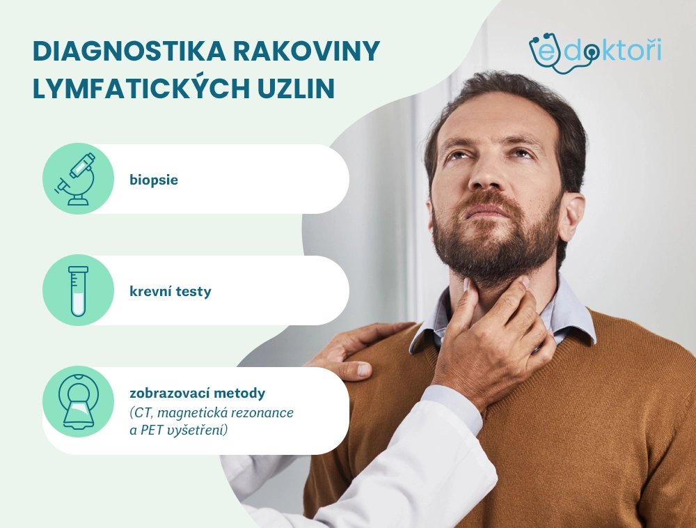 Jak se rakovina lymfatických uzlin diagnostikuje?