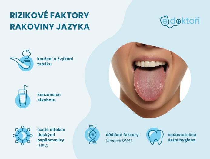 Rizikové faktory rakoviny jazyka