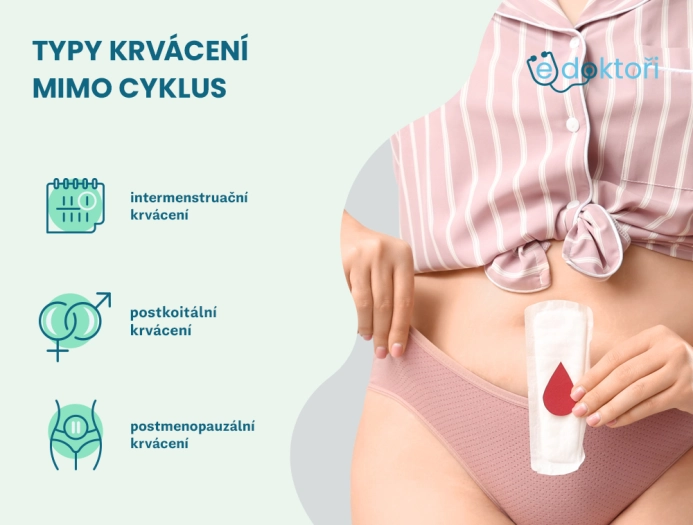 Typy krvácení mimo cyklus
