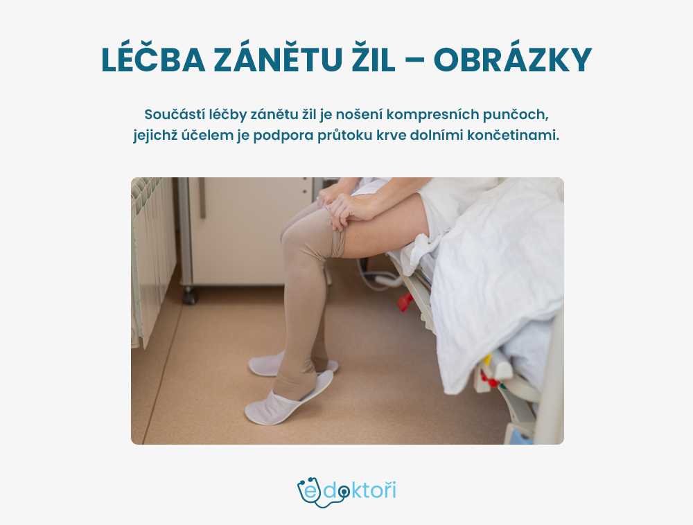 Autor: Redakce edoktori.cz Léčba zánětu žil