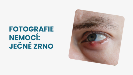 Ječné zrno