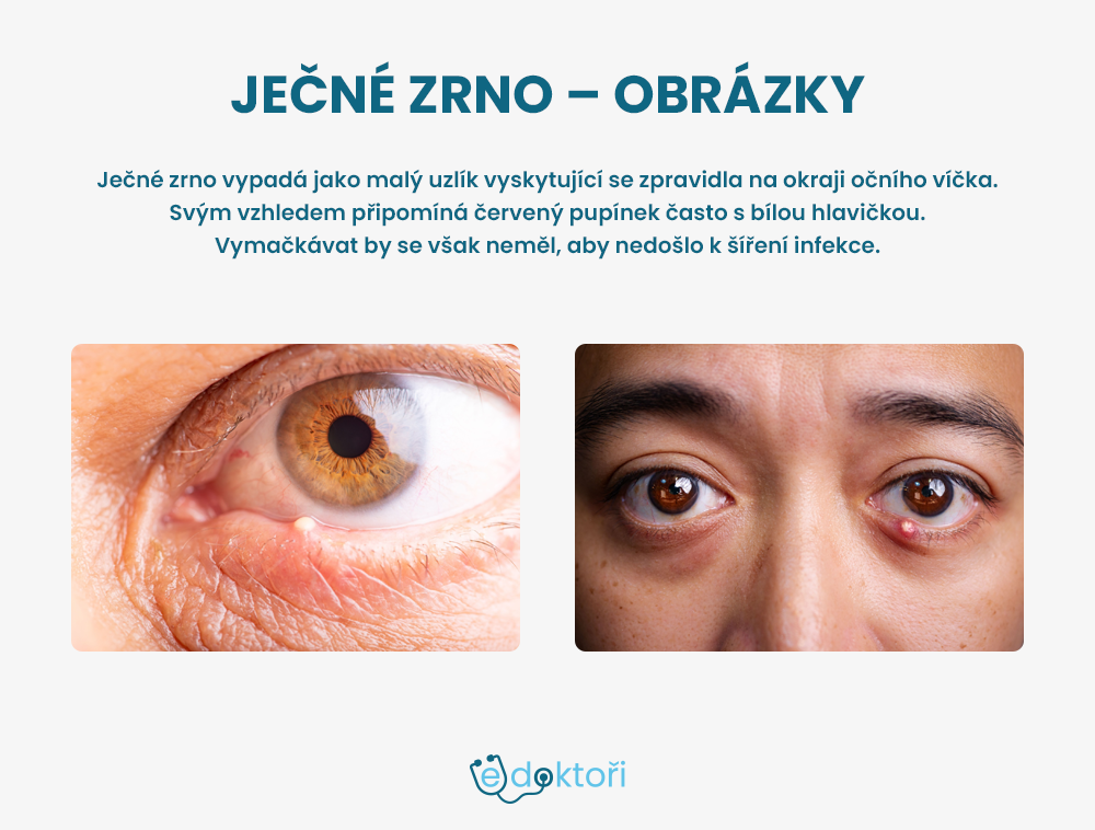Ječné zrno obrázky