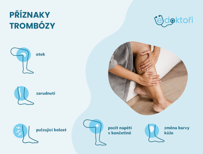 příznaky trombózy
