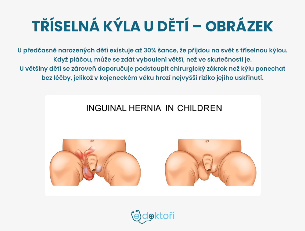 tříselná kýla u dětí