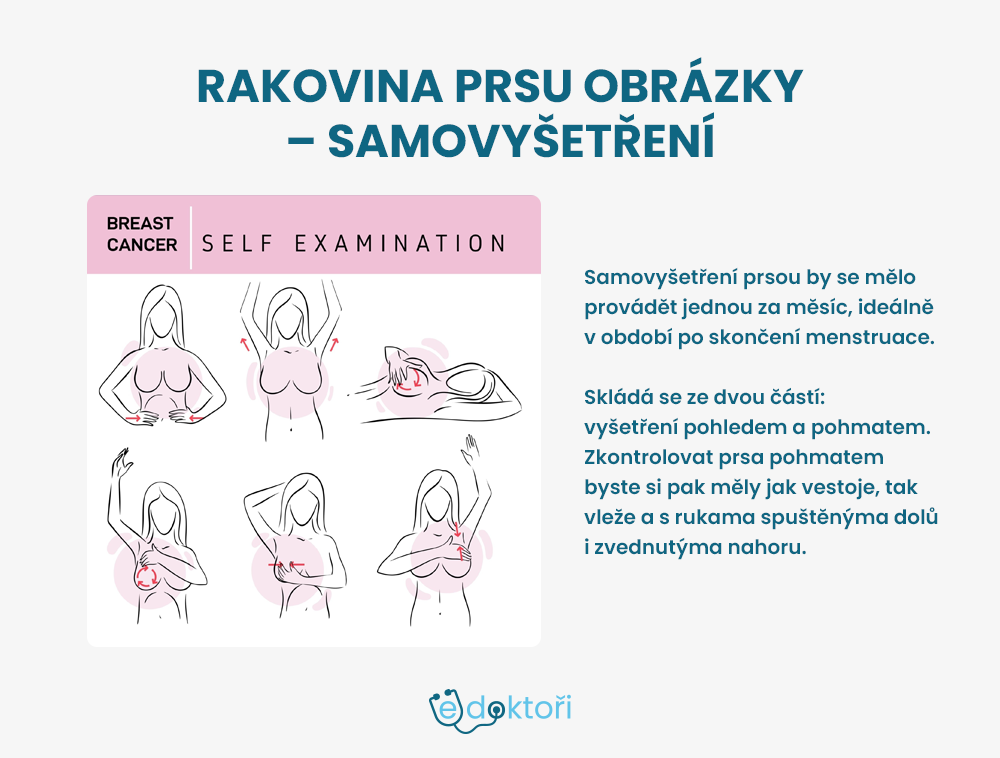 Autor: Redakce edoktori.cz rakovina prsu obrázky - samovyšetření