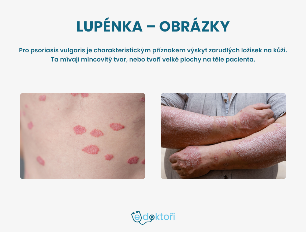 Lupénka obrázky