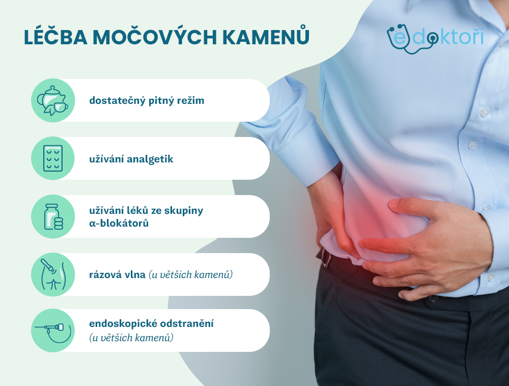 Léčba močových kamenů