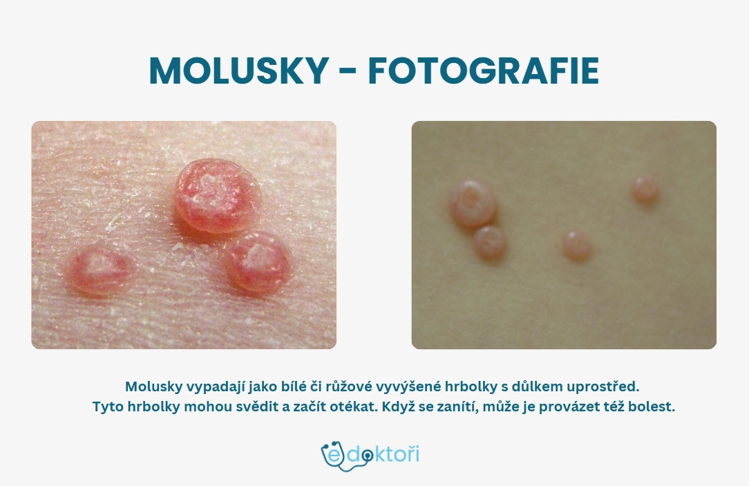 Molusky foto