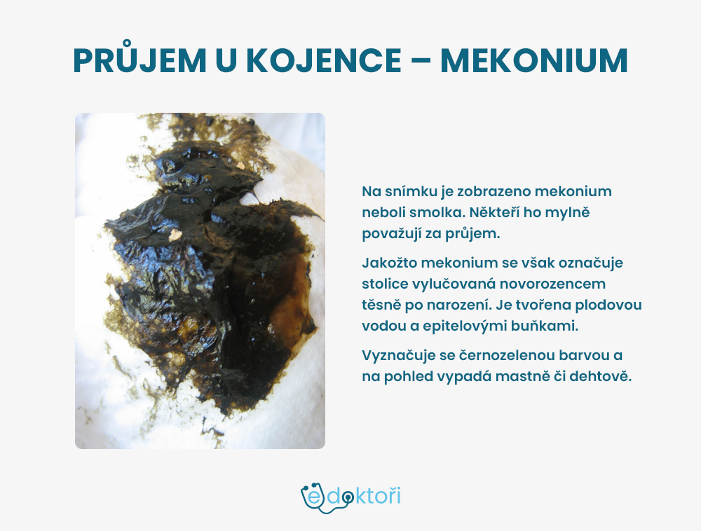 Autor: Redakce edoktori.cz mekonium foto
