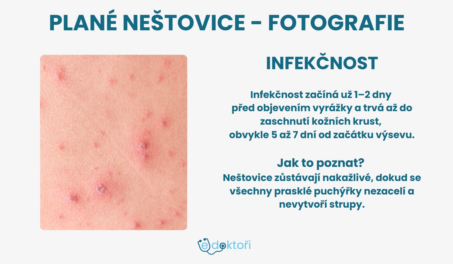 Plané neštovice foto