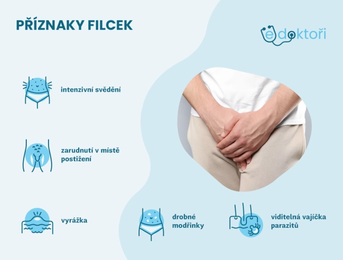 Filcky příznaky