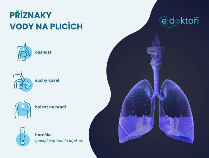 Jaké má voda na plicích příznaky?