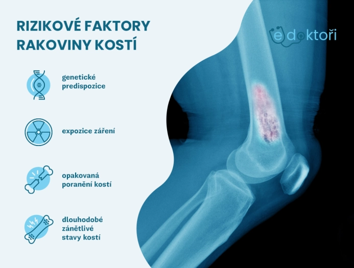 Rizikové faktory rakoviny kostí