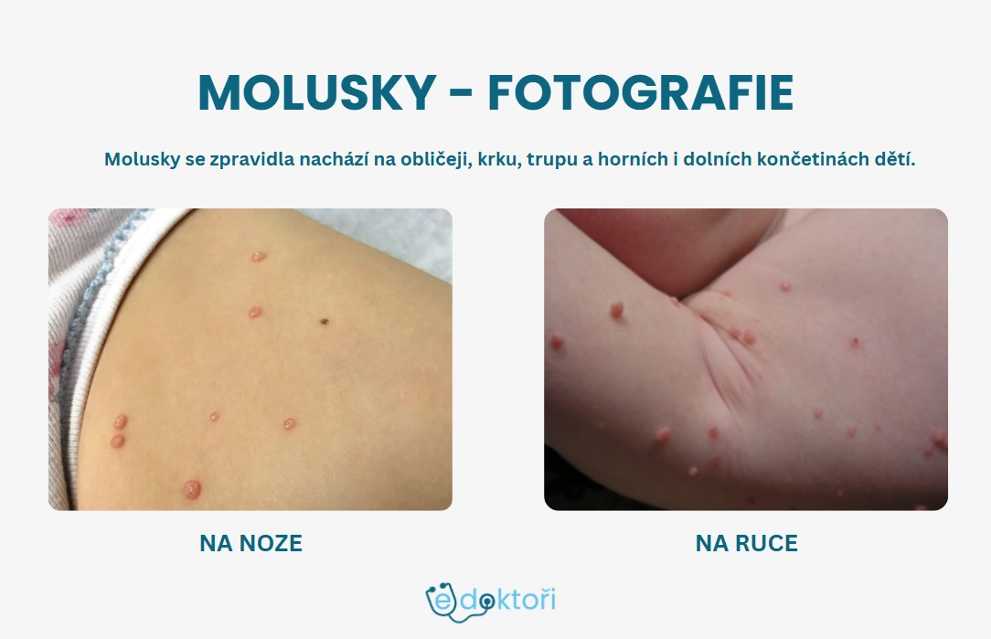 Molusky fotografie