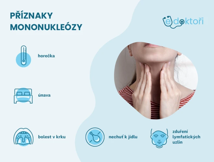 Jaké má mononukleóza příznaky?