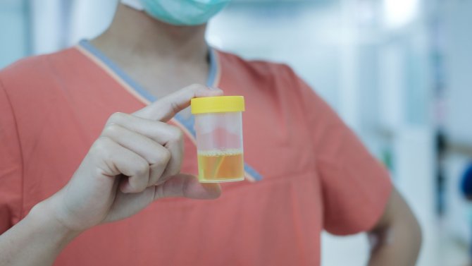 zánět močových cest vyšetření