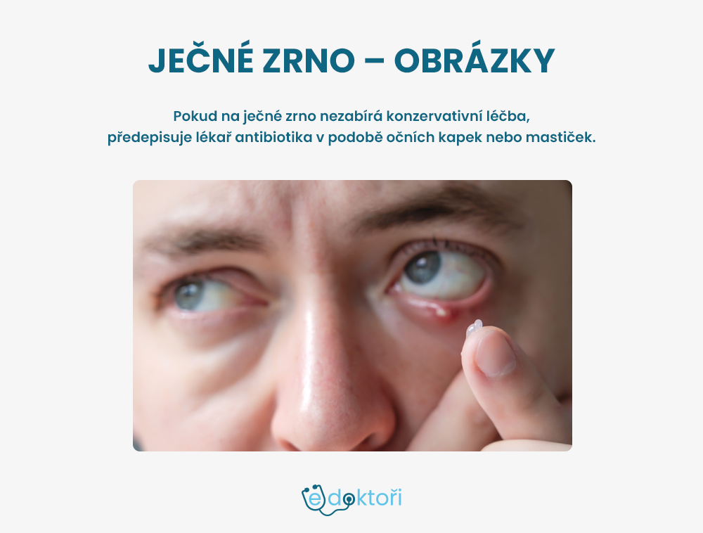 Ječné zrno léčba