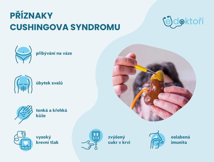 Příznaky Cushingova syndromu