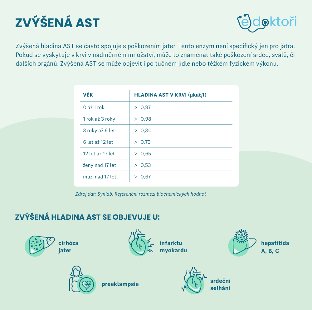 Autor: Redakce eDoktoři Zvýšená AST